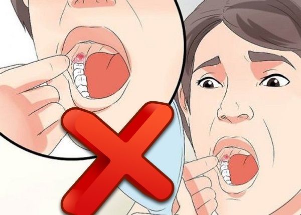 nhổ răng có đau không