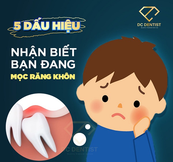 Nhận biết 5 dấu hiệu mọc răng khôn thường gặp nhất