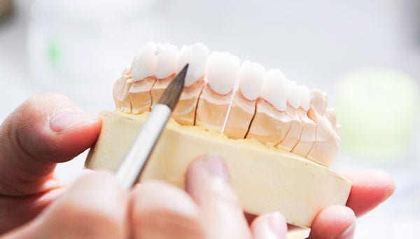 Công nghệ bọc răng sứ invy ultra 3p, bọc răng sứ công nghệ invy ultra 3p
