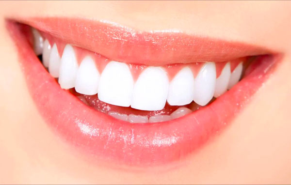 Xem tướng răng hạt lựu, tướng răng hạt lựu, răng hạt lựu là như thế nào, con gái răng hạt lựu, răng hạt lựu, hàm răng hạt lựu, Hình ảnh răng hạt lựu