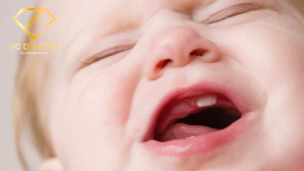 bé 7 tháng tuổi chưa mọc răng có sao không, 7 tháng tuổi chưa mọc răng, trẻ 7 tháng tuổi chưa mọc răng, em bé 7 tháng tuổi chưa mọc răng, bé 7 tháng chưa mọc răng có sao không, trẻ 7 tháng chưa mọc răng có sao không, trẻ 7 tháng chưa mọc răng