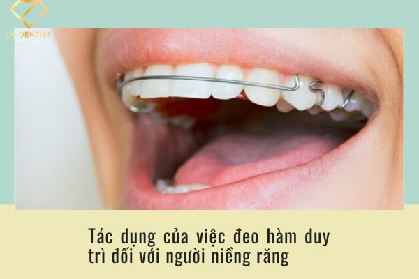sau khi niềng răng phải đeo hàm duy trì bao lâu, sau khi niềng răng đeo hàm duy trì, sau niềng răng phải đeo hàm duy trì bao lâu, sau khi niềng răng đeo hàm duy trì bao lâu, sau khi niềng răng đeo hàm duy trì, niềng răng xong phải đeo hàm duy trì bao lâu