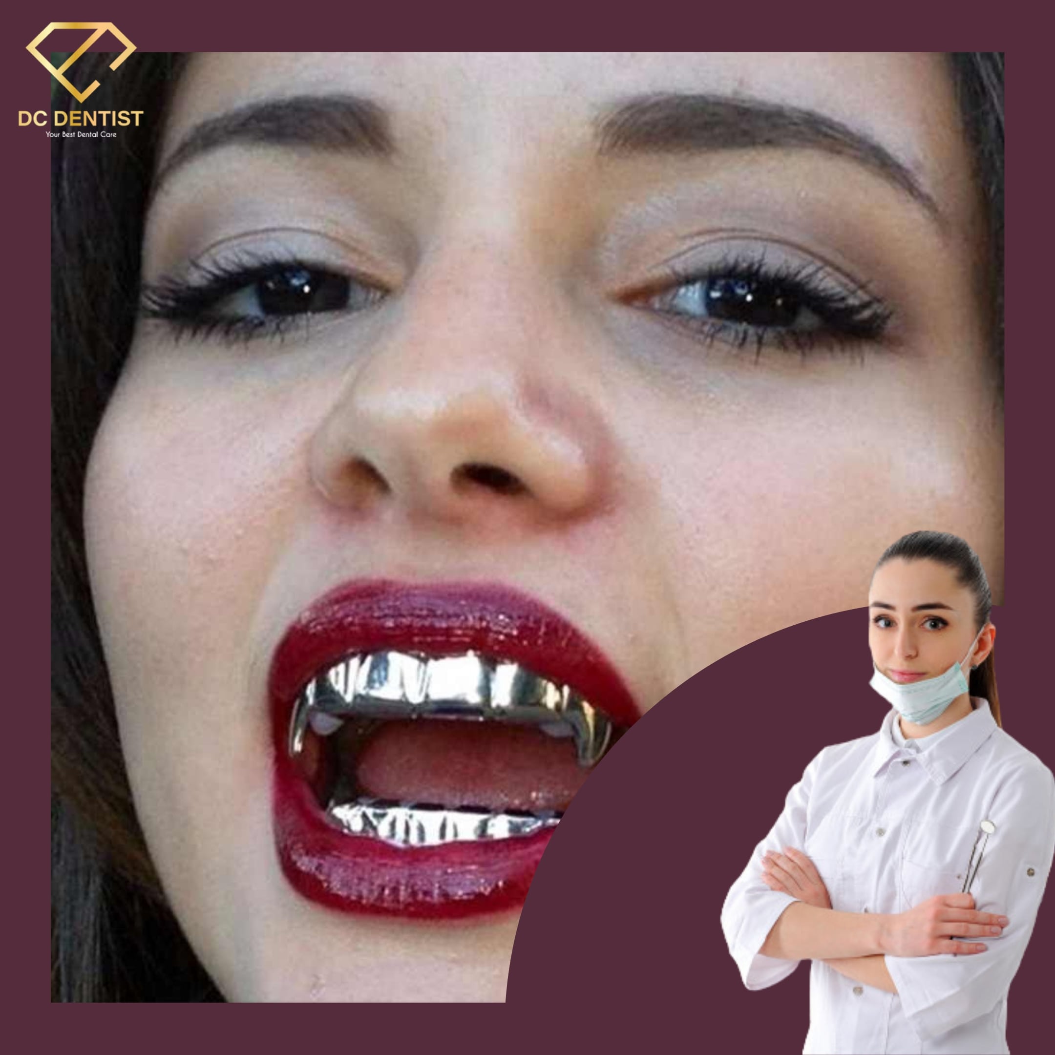 bọc răng bằng bạc giá bao nhiêu, bọc răng bạc, làm răng bọc bạc, làm răng bạc, bọc răng bằng bạc, mạ răng bạc, Giá bọc răng bạc