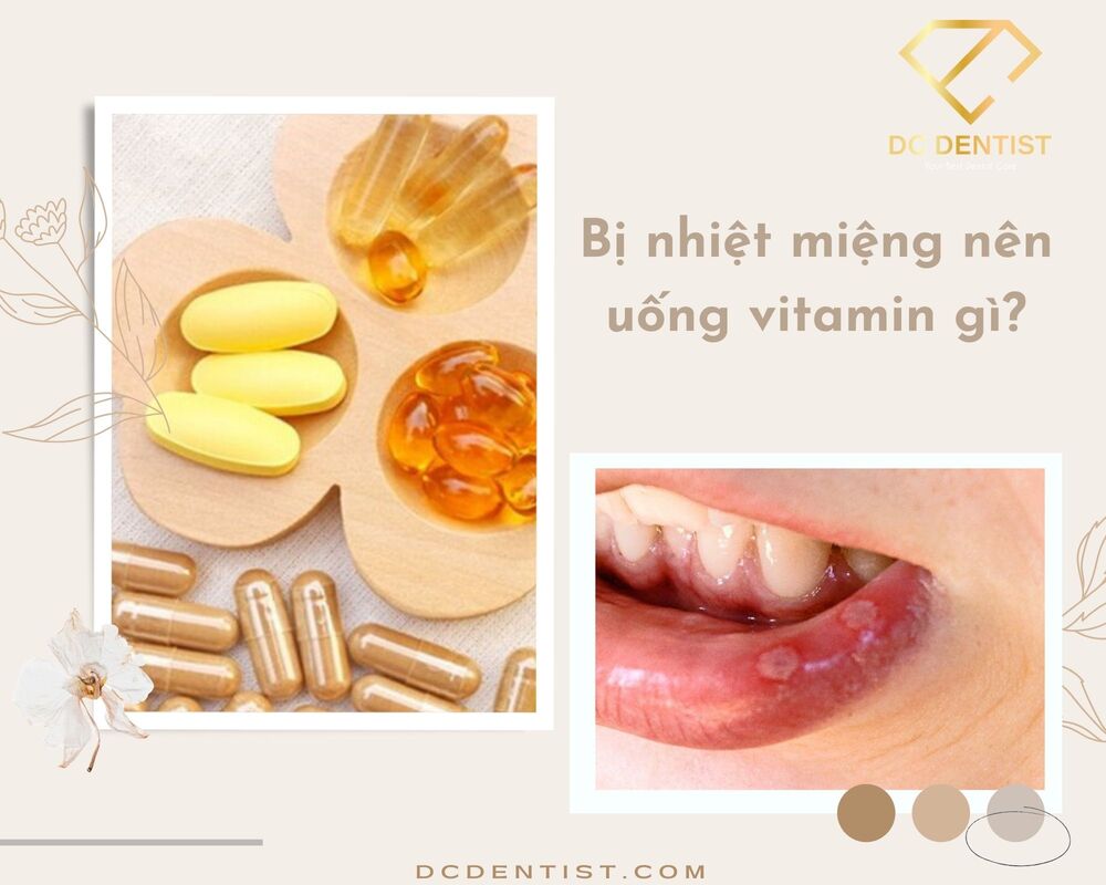 Bị nhiệt miệng nên uống vitamin gì? – Tuyệt chiêu cung cấp vitamin để nhiệt miệng nhanh cuốn gói
