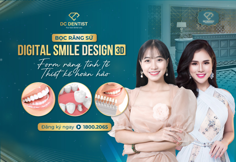 [OFF 50%] Bọc răng sứ Digital Smile Design 3D: Form răng tinh tế – Thiết kế hoàn hảo