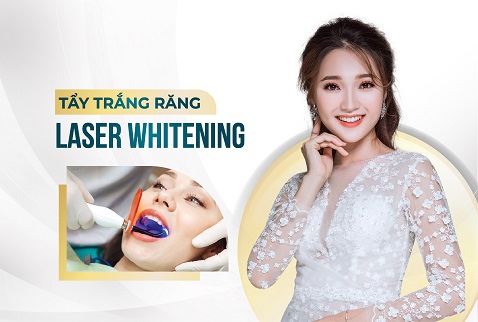 tẩy trắng răng ultra perfect whitening tại nha khoa DC Dentist